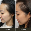 Escova de Terapia Capilar: TheraBrush Smarts 4 em 1